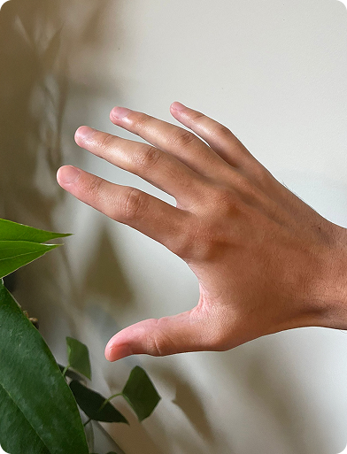 manos despuess (1) 1 manos despuess (1) 1